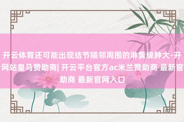 开云体育还可能出现结节隔邻周围的淋夤缘肿大-开云平台网站皇马赞助商| 开云平台官方ac米兰赞助商 最新官网入口